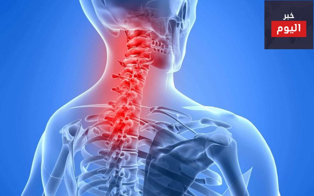آلام الرقبة - Neck Pain