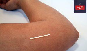 مانع الحمل المزروع - Contraceptive Implant