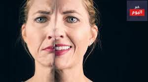 الاضطراب ثنائي القطب - Bipolar Disorder