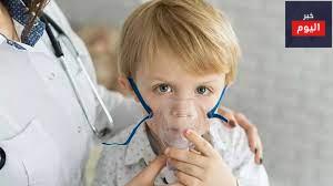 التهاب القصيبات - Bronchiolitis
