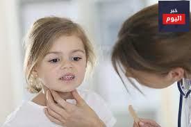 النكاف - Mumps