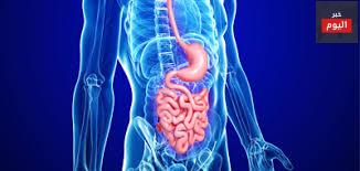 داء كرون - Crohns disease