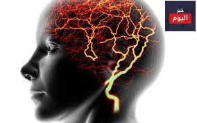 الصرع - Epilepsy