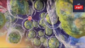 ابيضاض الدم النخاعي الحاد - Acute myeloid leukaemia