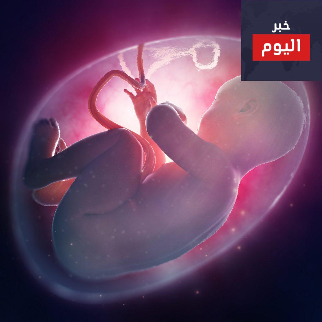 ما هي المشكلات الناتجة عن نقص السائل الأمينوسي؟