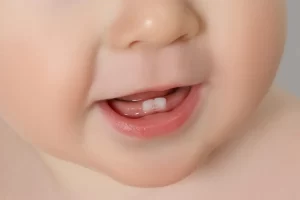 كيف تعتنين بأسنان رضيعك؟