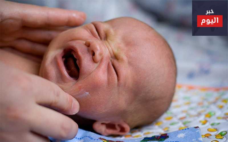 لماذا يبدو طفلي حديث الولادة أصفر اللون؟