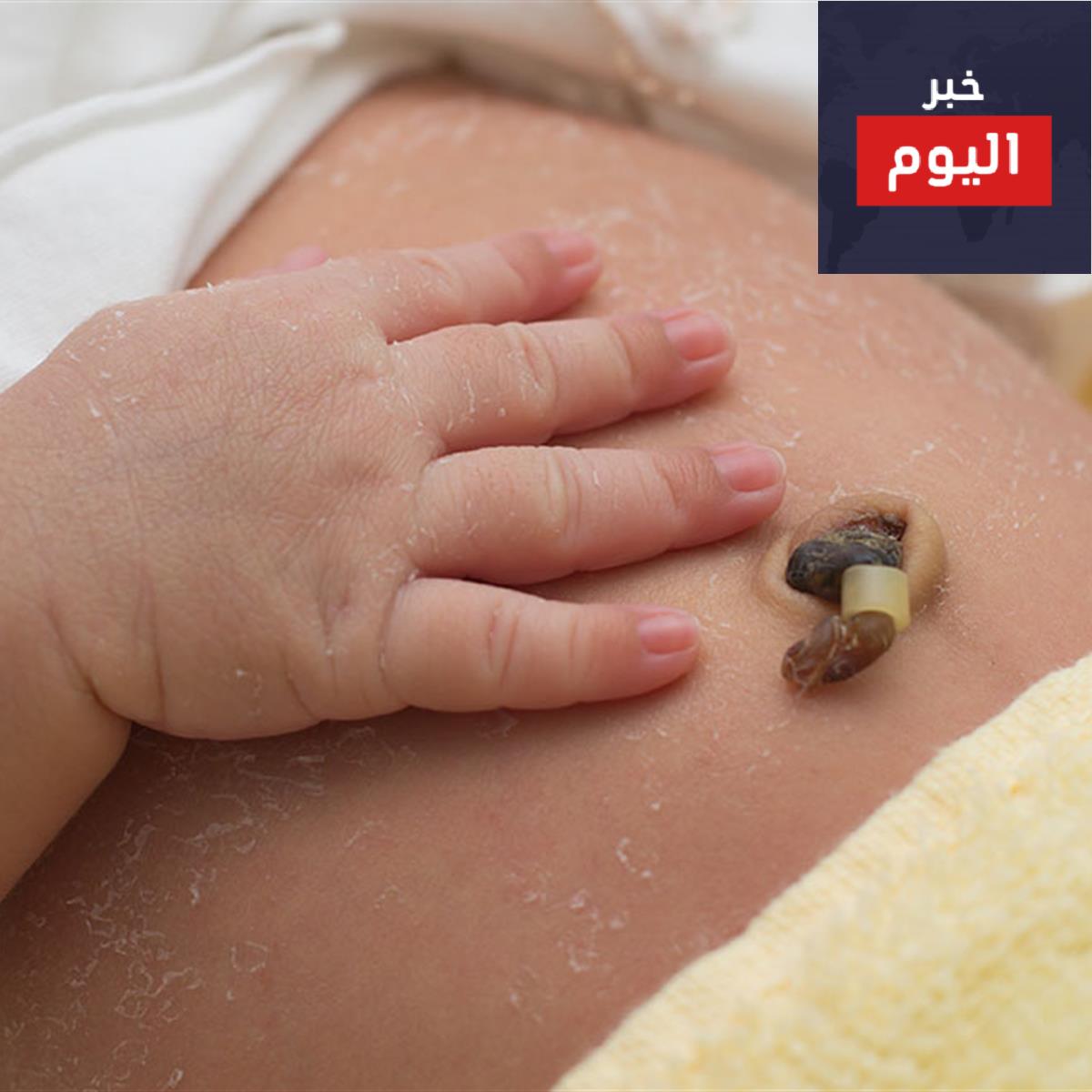 الحبل السّري، والسرة والعناية بهما