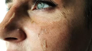 تقشير البشرة العميق يخلصك من البقع السمراء والتجاعيد