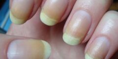 طرقٌ فعّالة لإزالة اللون الأصفر عن أظافرك