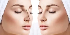 عملية تجميل الأنف