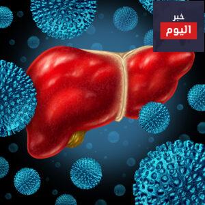 أعراض فيروس سي وعلاجه