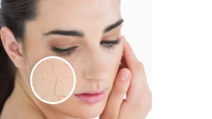 خطوات بسيطة وسهلة لمكياج البشرة الجافة