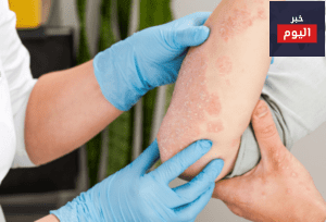 a dermatologist wearing gloves examines the skin of a sick patient 17g2gjc69rivhi6rsjslwg2y2jq42sv9i2boh1nk36wsa9oy 1