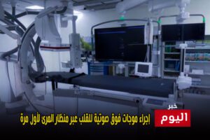 إجراء موجات فوق صوتية للقلب