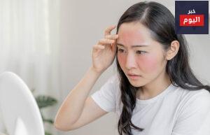 كل ما تحتاج لمعرفته حول كحول السيتريل للبشرة