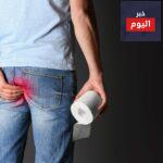 الناسور الشرجي أسبابه وطرق علاجه ومضاعفاته