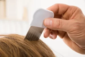اسرع طريقة للتخلص من القمل