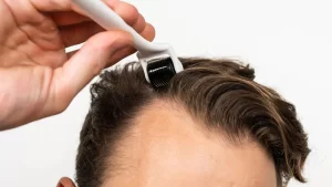 طريقة استعمال ديرما رولر للشعر