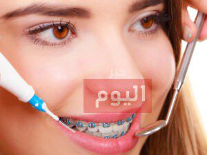 طريقة تركيب التقويم
