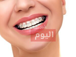 طريقة تركيب التقويم