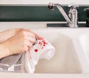 طريقة إزالة بقع الدم من المفروشات