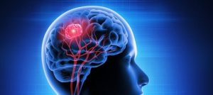 10 مستلزمات منزلية شائعة تؤثر على صحة الدماغ والذاكرة